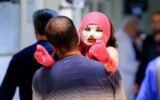 آسیب‌دیدگی چشم بانوی 40 ساله اردستانی